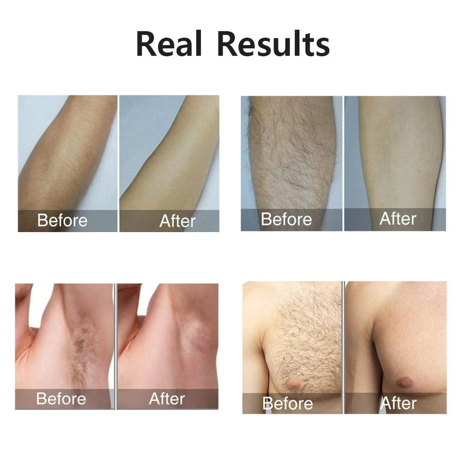 AligniX™ Hair Removal Tool