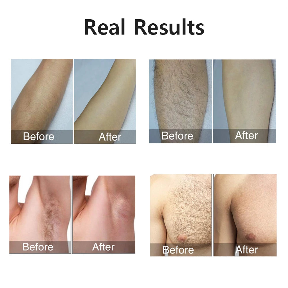 AligniX™ Hair Removal Tool
